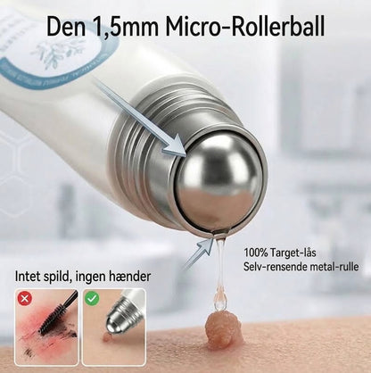 Rollerball™ Serum mod vorter og hudforandringer