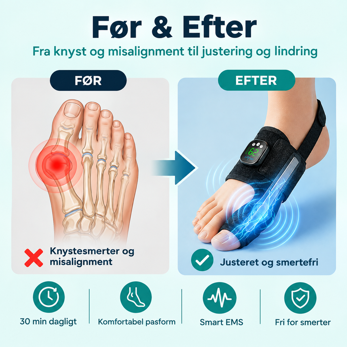 AlignStep™ EMS Knystkorrigerer
