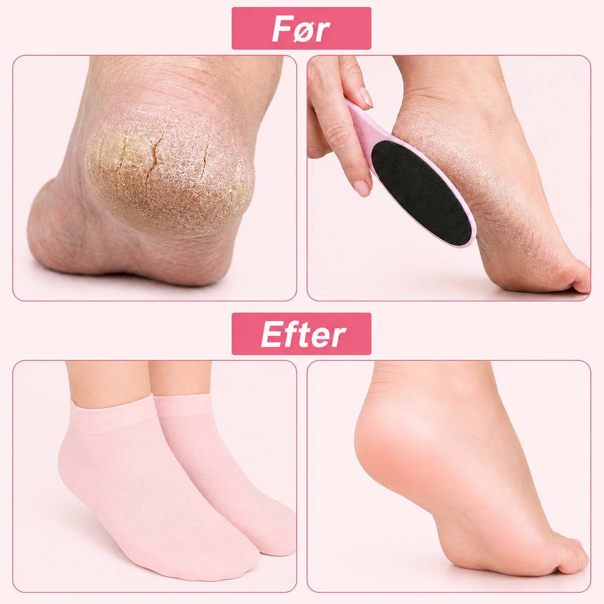 SoftStep™ Fugtgivende Silikonesokker (1 par + 1 par GRATIS)