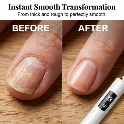 Nailora™ | Elektrisk Manicure- & Pedicuresæt
